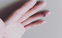 伤残等级如何鉴定